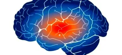 cerebrovascular