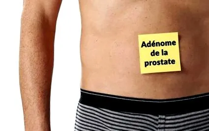 adenoma tünetei