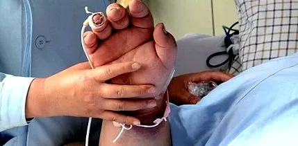 cancer supraponderabilității