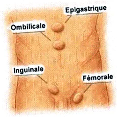 emészetes
