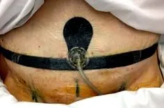 chirurgie