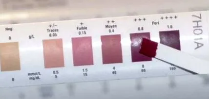 keto lehet