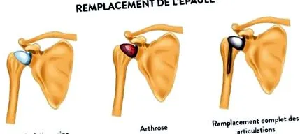 diagnosticul