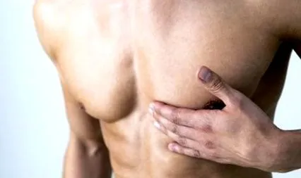 paris gynecomastia