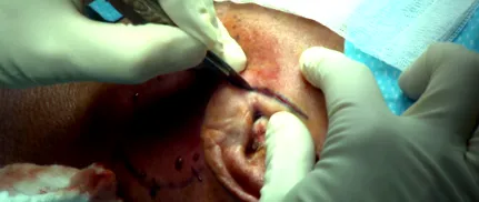 daganatai InfoCancer ARCAGY
