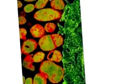 mycoplasma