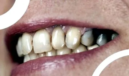 dentară