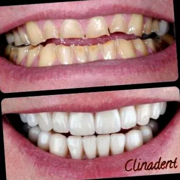 centrul