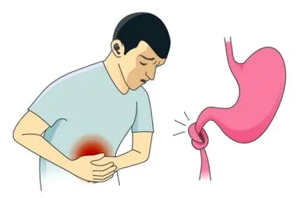 intestinul sindromul