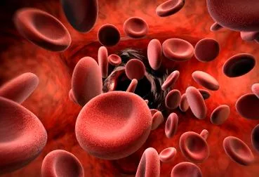 polycythemia