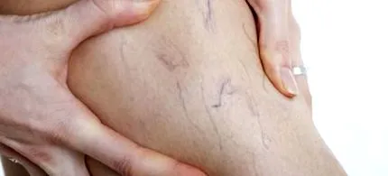 mikroegyensúly