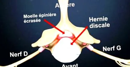 espace