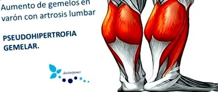 reumatológica