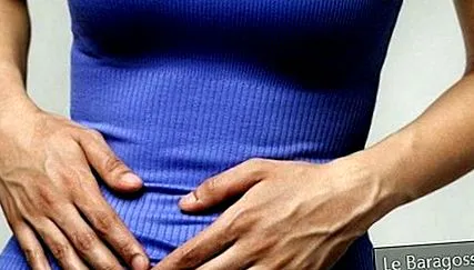 cholelithiasis