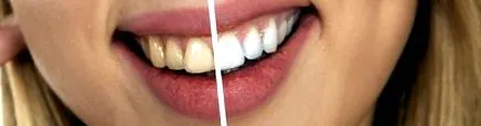 dentar tratamente