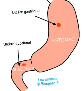 ebben esetben