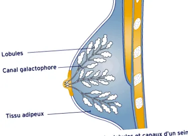 ductalis carcinoma