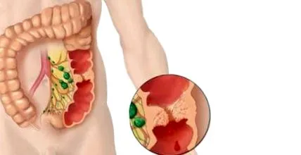 digestiv
