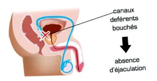 disfuncție