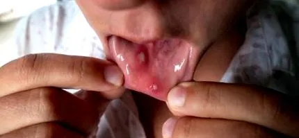 buena