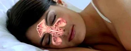 elme