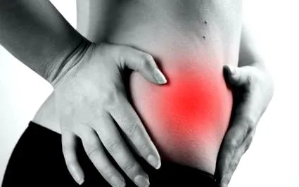 endometriózis