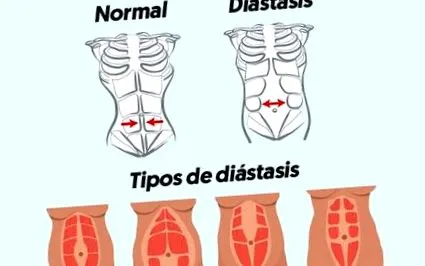 diastaza identificați