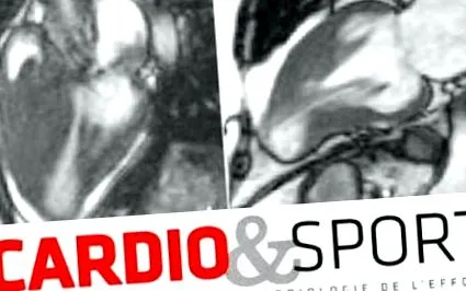 hipertrofic cardiomiopatic