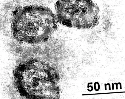 hepatita