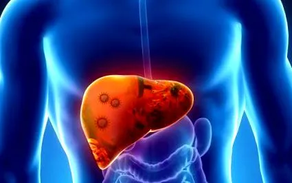 hepatitis