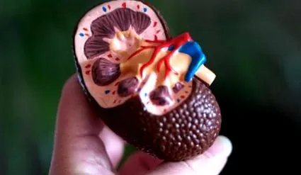 calculi calculi