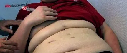 amenință obezitatea