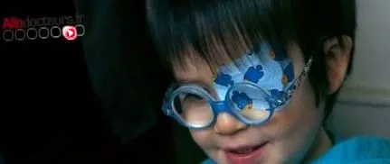 amblyopia amblyopia