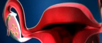 menstruáció alatt