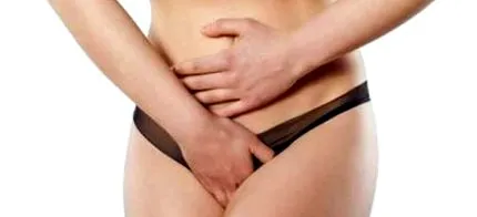candidiasis