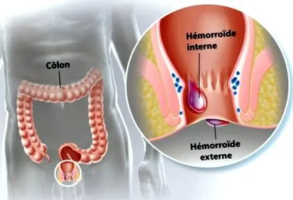 clinica