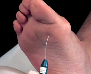 rolul diabetic