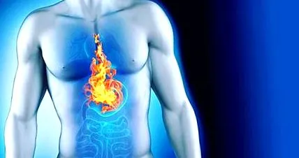 reflux
