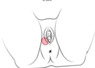 gynecologie
