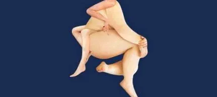 скляна поява