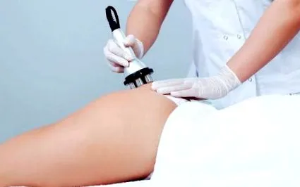кавитация