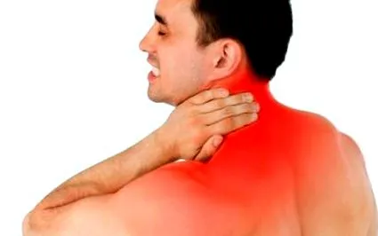 radiculopathiák
