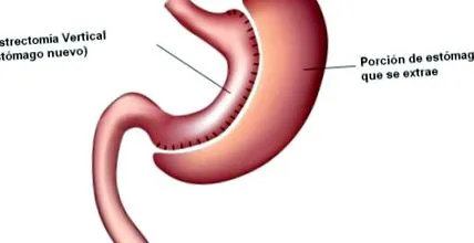 tubulus