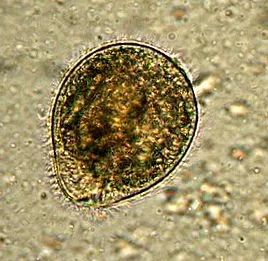 balantidium