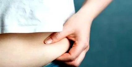 uimitoare