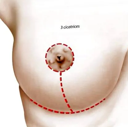 chirurgie pentru