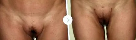 естетична