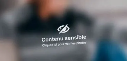 liposucție