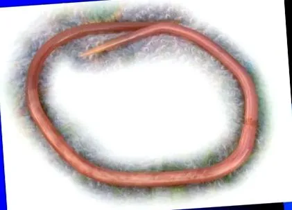 ascaridioza