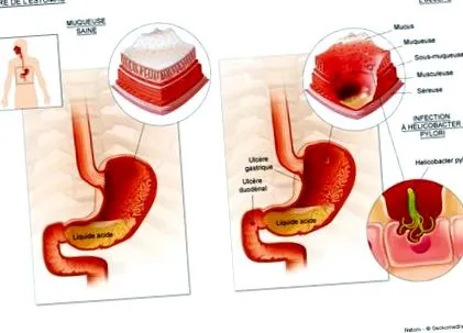 cancerologie
